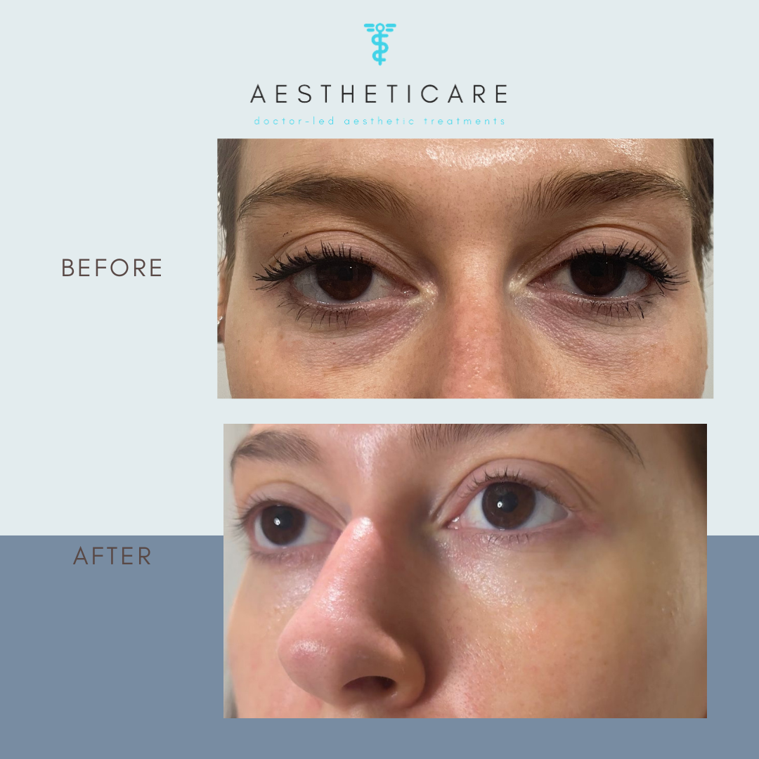 AesthetiCare Clinic