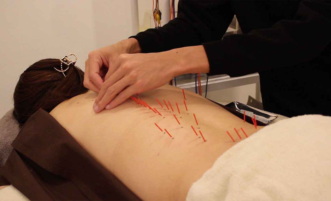 Ginza Acupuncture & Pilates KANAU