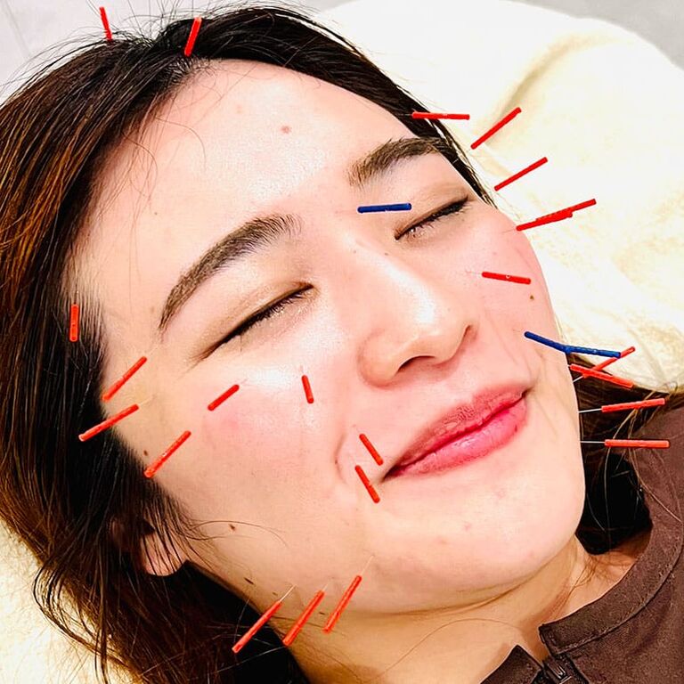 Ginza Acupuncture & Pilates KANAU