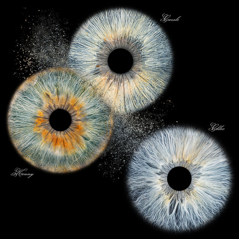 Iristellar