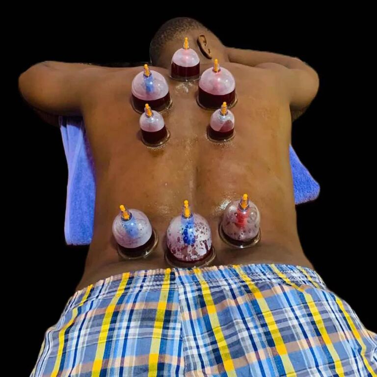 Safari Cupping Therapy