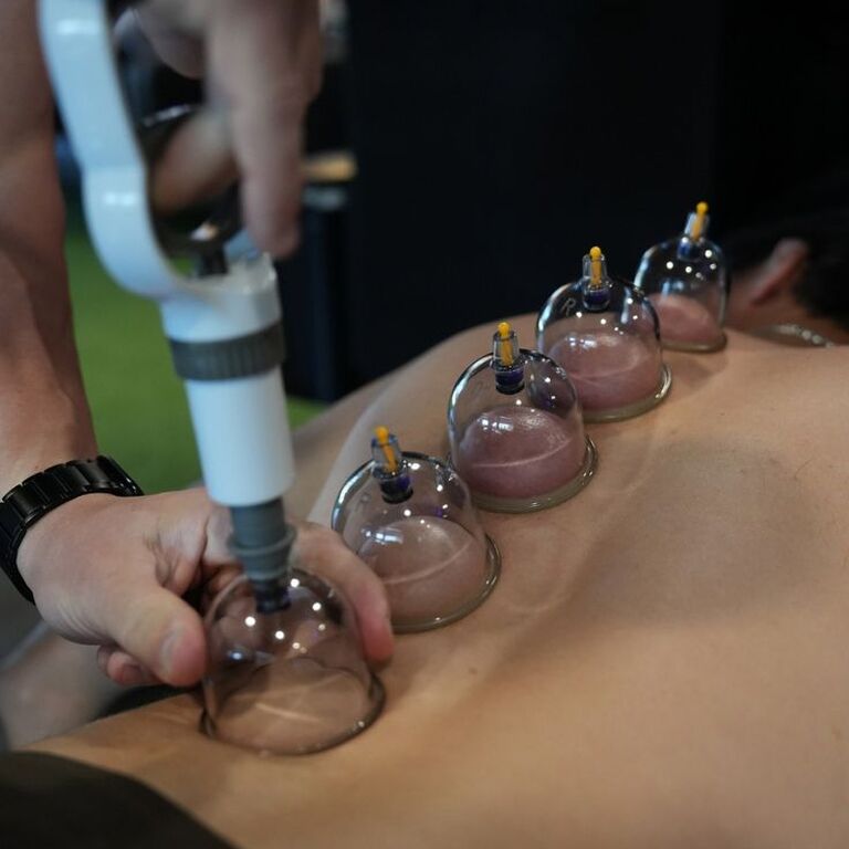 Safari Cupping Therapy